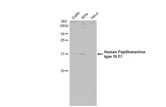 Western Blot: HPV16 E7 Antibody (HL1821) - Azide and BSA Free [NBP3-25511] - Various whole cell extracts (30 ug) were separated by 15% SDS-PAGE, and the membrane was blotted with Human Papillomavirus type 16 E7 antibody [HL1821] (NBP3-25511) diluted at 1:1000. The HRP-conjugated anti-rabbit IgG antibody was used to detect the primary antibody, and the signal was developed with Trident ECL plus-Enhanced.