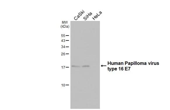 Western Blot HPV16 E7 Antibody (HL1821) - Azide and BSA Free