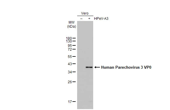 Western Blot: Human Parechovirus 1/3 VP0 Antibody (HL2443) - Azide and BSA Free [NBP3-25513] - Non-infected (-) and infected (+) Vero whole cell extracts (30 ug) were separated by 12% SDS-PAGE, and the membrane was blotted with Human Parechovirus 1+3 VP0 antibody [HL2443] (NBP3-25513) diluted at 1:1000. The HRP-conjugated anti-rabbit IgG antibody was used to detect the primary antibody.