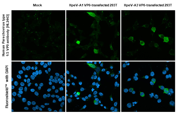 Immunocytochemistry/Immunofluorescence: Human Parechovirus 1/3 VP0 Antibody (HL2443) - Azide and BSA Free [NBP3-25513] - Human Parechovirus type 1/3 VP0 antibody [HL2443] detects Human Parechovirus type 1/3 VP0 protein by immunofluorescent analysis. Sample: Mock and transfected 293T cells were fixed in 4% paraformaldehyde at RT for 15 min. Green: Human Parechovirus type 1/3 VP0 stained by Human Parechovirus type 1/3 VP0 antibody [HL2443] (NBP3-25513) diluted at 1:500. Blue: Fluoroshield with DAPI .