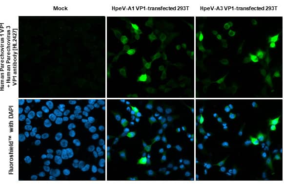 Immunocytochemistry/Immunofluorescence: Human Parechovirus 1/3 VP1 Antibody (HL2427) - Azide and BSA Free [NBP3-25514] - Human Parechovirus 1+3 VP1 antibody [HL2427] detects Human Parechovirus 1+3 VP1 protein by immunofluorescent analysis. Sample: Mock and transfected 293T cells were fixed in 4% paraformaldehyde at RT for 15 min. Green: Human Parechovirus 1+3 VP1 stained by Human Parechovirus 1+3 VP1 antibody [HL2427] (NBP3-25514) diluted at 1:1000. Blue: Fluoroshield with DAPI .