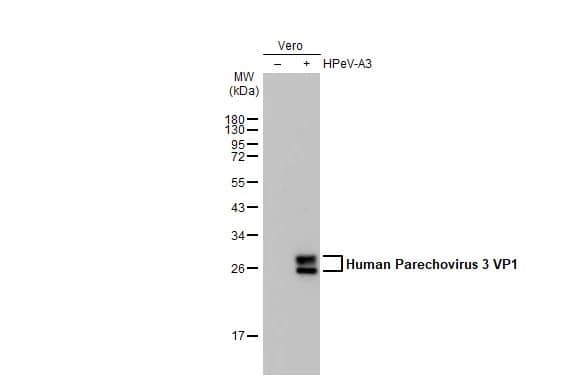 Western Blot: Human Parechovirus 1/3 VP1 Antibody (HL2427) - Azide and BSA Free [NBP3-25514] - Non-infected (-) and infected (+) Vero whole cell extracts (30 ug) were separated by 12% SDS-PAGE, and the membrane was blotted with Human Parechovirus 1+3 VP1 antibody [HL2427] (NBP3-25514) diluted at 1:2000. The HRP-conjugated anti-rabbit IgG antibody was used to detect the primary antibody.