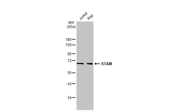 Western Blot: STAM-1 Antibody (HL1635) - Azide and BSA Free [NBP3-25518] - Various whole cell extracts (30 ug) were separated by 10% SDS-PAGE, and the membrane was blotted with STAM antibody [HL1635] (NBP3-25518) diluted at 1:1000. The HRP-conjugated anti-rabbit IgG antibody was used to detect the primary antibody.