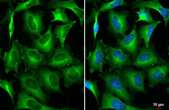 Immunocytochemistry/Immunofluorescence: STAM-1 Antibody (HL1635) - Azide and BSA Free [NBP3-25518] - STAM antibody [HL1635] detects STAM protein at cytoplasm by immunofluorescent analysis. Sample: HeLa cells were fixed in 4% paraformaldehyde at RT for 15 min. Green: STAM stained by STAM antibody [HL1635] (NBP3-25518) diluted at 1:500. Blue: Fluoroshield with DAPI .