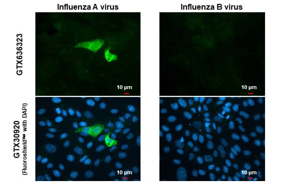 Immunocytochemistry/Immunofluorescence: Influenza A H1N1 Neuraminidase Antibody (HL1108) - Azide and BSA Free [NBP3-25523] - Influenza A virus H1N1 NA (Neuraminidase) antibody [HL1108] detects Influenza A virus H1N1 NA (Neuraminidase) protein by immunofluorescent analysis. Sample: Influenza A and B Virus infected cells slide cells were fixed in Influenza Kit. Green: Influenza A virus H1N1 NA (Neuraminidase) stained by Influenza A virus H1N1 NA (Neuraminidase) antibody [HL1108] (NBP3-25523) diluted at 1:100. Blue: Fluoroshield with DAPI .