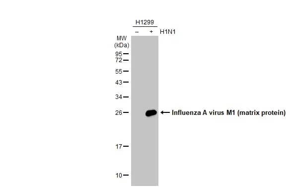 Western Blot: Influenza A H1N1 M1 Antibody (HL1273) - Azide and BSA Free [NBP3-25524] - Non-infected (-) and infected (+) H1299 whole cell extracts (15 ug) were separated by 12% SDS-PAGE, and the membrane was blotted with Influenza A virus M1 (matrix protein) antibody [HL1273] (NBP3-25524) diluted at 1:5000. The HRP-conjugated anti-rabbit IgG antibody was used to detect the primary antibody.