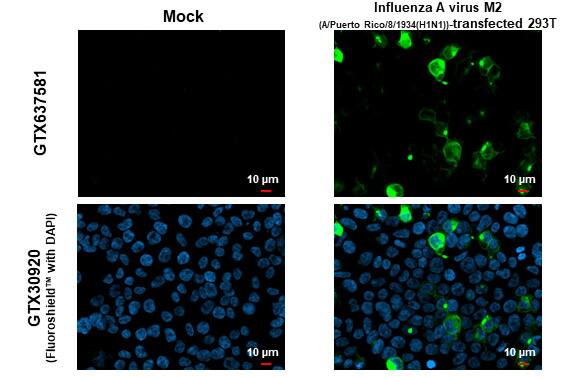 Immunocytochemistry/ Immunofluorescence Influenza A H1N1 M2 Antibody (HL1856) - Azide and BSA Free
