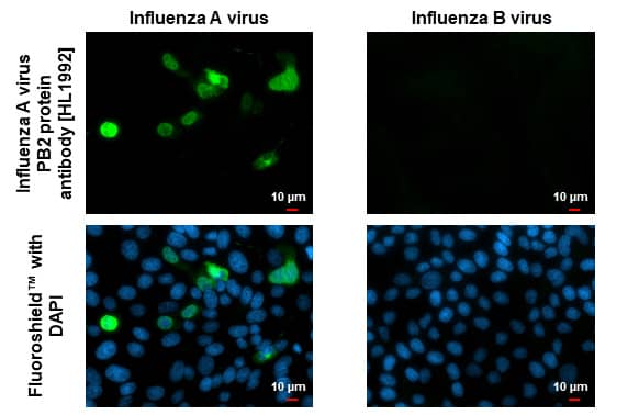 Immunocytochemistry/Immunofluorescence: Influenza A H1N1 PB2 Antibody (HL1992) - Azide and BSA Free [NBP3-25532] - Immunofluorescent analysis of Influenza virus infected cells using Influenza A virus PB2 protein antibody [HL1992] (NBP3-25532). Sample: Influenza A and B virus infected cells slide. Green: Influenza A virus PB2 protein antibody [HL1992] (NBP3-25532) diluted at 1:100. Blue: Fluoroshield with DAPI .
