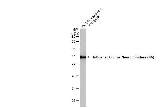 Influenza B viral lysate (1 ug) was separated by 10% SDS-PAGE, and the membrane was blotted with Influenza B Virus Neuraminidase antibody [HL1476] (NBP3-25534) diluted at 1:5000. The HRP-conjugated anti-rabbit IgG antibody was used to detect the primary antibody. 