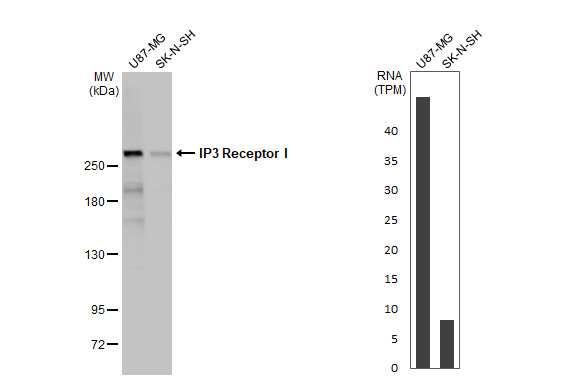 <b>Orthogonal Strategies Validation. </b>Various whole cell extracts (30 ug) were separated by 5% SDS-PAGE, and the membrane was blotted with IP3R1 antibody [HL1541] (NBP3-25535) diluted at 1:1000. The HRP-conjugated anti-rabbit IgG antibody was used to detect the primary antibody. Corresponding RNA expression data for the same cell lines are based on Human Protein Atlas program. 