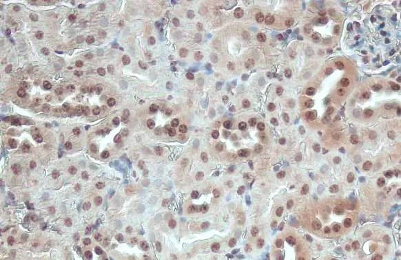 Immunohistochemistry-Paraffin: ITK Antibody (HL1264) - Azide and BSA Free [NBP3-25538] - ITK antibody [HL1264] detects ITK protein at cytoplasm and nucleus by immunohistochemical analysis. Sample: Paraffin-embedded mouse kidney. ITK stained by ITK antibody [HL1264] (NBP3-25538) diluted at 1:100. Antigen Retrieval: Citrate buffer, pH 6.0, 15 min