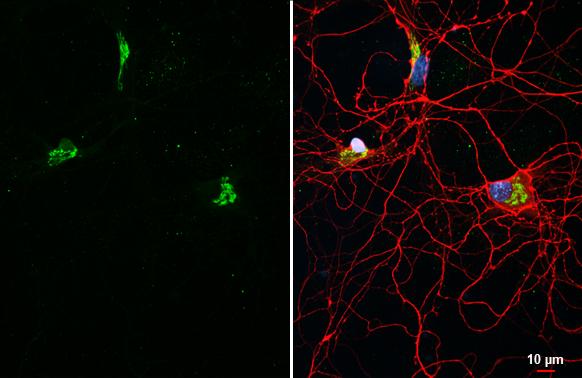 KCC2/SLC12A5 antibody [HL2535] detects KCC2/SLC12A5 protein at Glogi by immunofluorescent analysis.Sample: DIV9 rat E18 primary hippocampal neuron cells were fixed in 4% paraformaldehyde at RT for 15 min.Green: KCC2/SLC12A5 stained by KCC2/SLC12A5 antibody [HL2535] (NBP3-25541) diluted at 1:250.Red: Tau, an axon marker, stained by Tau antibody [GT287] diluted at 1:500.Blue: Fluoroshield with DAPI . 
