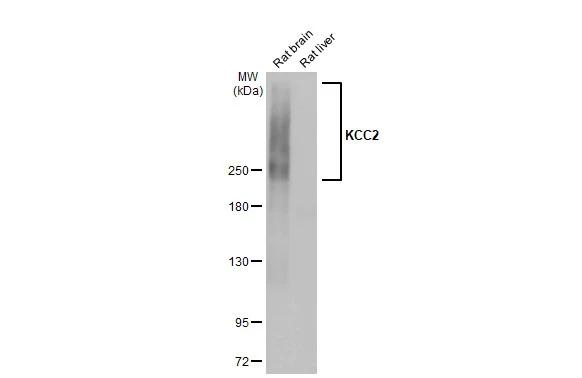 Various tissue extracts (50 �g) were separated by 5% SDS-PAGE, and the membrane was blotted with KCC2/SLC12A5 antibody [HL2535] (NBP3-25541) diluted at 1:1000. The HRP-conjugated anti-rabbit IgG antibody was used to detect the primary antibody, and the signal was developed with Trident ECL plus-Enhanced. 
