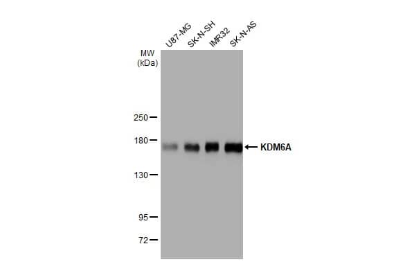 <b>Orthogonal Strategies Validation. </b>Western Blot: KDM6A Antibody (HL1731) - Azide and BSA Free [NBP3-25542] - Various whole cell extracts (30 ug) were separated by 5% SDS-PAGE, and the membrane was blotted with KDM6A antibody [HL1731] (NBP3-25542) diluted at 1:1000. The HRP-conjugated anti-rabbit IgG antibody was used to detect the primary antibody.