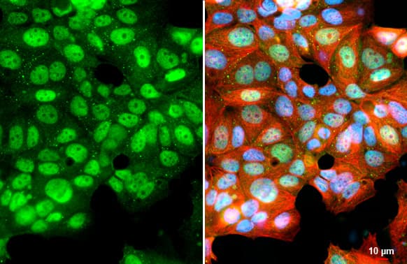 Immunocytochemistry/Immunofluorescence: KDM6A Antibody (HL1731) - Azide and BSA Free [NBP3-25542] - KDM6A antibody [HL1731] detects KDM6A protein by immunofluorescent analysis. Sample: MCF-7 cells were fixed in 4% paraformaldehyde at RT for 15 min. Green: KDM6A stained by KDM6A antibody [HL1731] (NBP3-25542) diluted at 1:500. Red: alpha Tubulin, a cytoskeleton marker, stained by alpha Tubulin antibody [GT114] (NBP2-43837) diluted at 1:1000. Blue: Fluoroshield with DAPI . Scale bar= 10um.