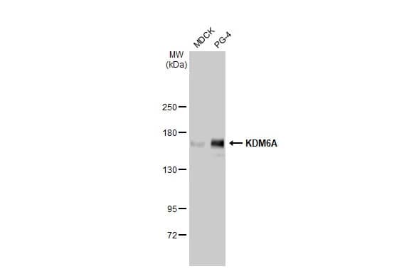 Western Blot: KDM6A Antibody (HL1731) - Azide and BSA Free [NBP3-25542] - Various whole cell extracts (30 ug) were separated by 5% SDS-PAGE, and the membrane was blotted with KDM6A antibody [HL1731] (NBP3-25542) diluted at 1:1000. The HRP-conjugated anti-rabbit IgG antibody was used to detect the primary antibody.