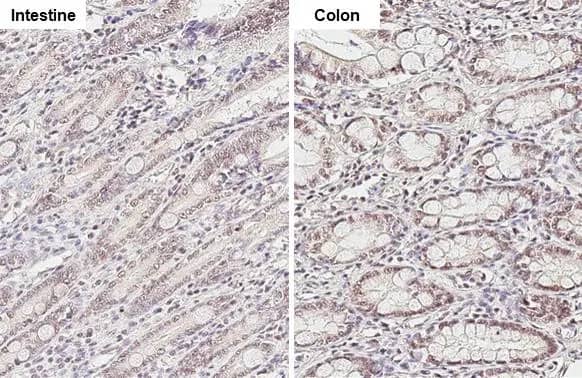 Immunohistochemistry-Paraffin: KDM6A Antibody (HL1731) - Azide and BSA Free [NBP3-25542] - KDM6A antibody [HL1731] detects KDM6A protein by immunohistochemical analysis. Sample: Paraffin-embedded cat tissue. KDM6A stained by KDM6A antibody [HL1731] (NBP3-25542) diluted at 1:100. Antigen Retrieval: Citrate buffer, pH 6.0, 15 min