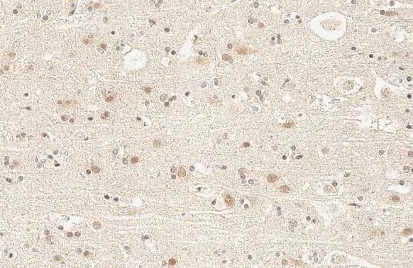 Immunohistochemistry-Paraffin: KDM6A Antibody (HL1731) - Azide and BSA Free [NBP3-25542] - KDM6A antibody [HL1731] detects KDM6A protein by immunohistochemical analysis. Sample: Paraffin-embedded dog brain. KDM6A stained by KDM6A antibody [HL1731] (NBP3-25542) diluted at 1:100. Antigen Retrieval: Citrate buffer, pH 6.0, 15 min