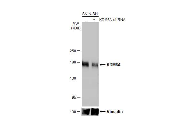 <b>Genetic Strategies Validation. </b>Knockdown Validated: KDM6A Antibody (HL1731) - Azide and BSA Free [NBP3-25542] - Non-transfected (-) and transfected (+) SK-N-SH whole cell extracts (30 ug) were separated by 5% SDS-PAGE, and the membrane was blotted with KDM6A antibody [HL1731] (NBP3-25542) diluted at 1:1000. The HRP-conjugated anti-rabbit IgG antibody was used to detect the primary antibody.