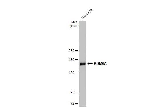 Western Blot: KDM6A Antibody (HL2068) - Azide and BSA Free [NBP3-25543] - Various whole cell extracts (50 ug) was separated by 5% SDS-PAGE, and the membrane was blotted with KDM6A antibody [HL2068] (NBP3-25543) diluted at 1:1000. The HRP-conjugated anti-rabbit IgG antibody was used to detect the primary antibody.