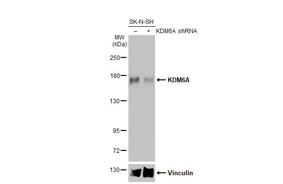 Knockdown Validated KDM6A Antibody (HL2068) - Azide and BSA Free