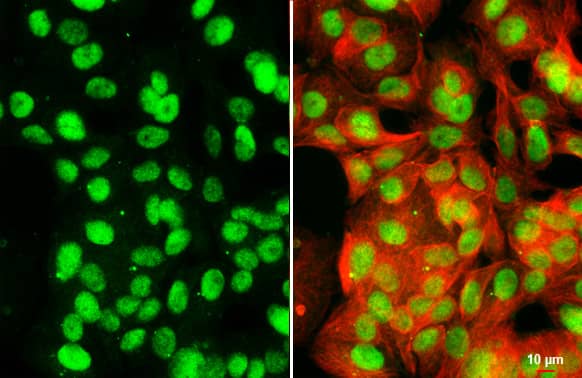 Immunocytochemistry/Immunofluorescence: KDM6A Antibody (HL2068) - Azide and BSA Free [NBP3-25543] - KDM6A antibody [HL2068] detects KDM6A protein at nucleus by immunofluorescent analysis. Sample: MCF-7 cells were fixed in ice-cold MeOH for 5 min. Green: KDM6A stained by KDM6A antibody [HL2068] (NBP3-25543) diluted at 1:500. Red: alpha Tubulin, a cytoskeleton marker, stained by alpha Tubulin antibody [GT114] diluted at 1:1000. Scale bar= 10um.