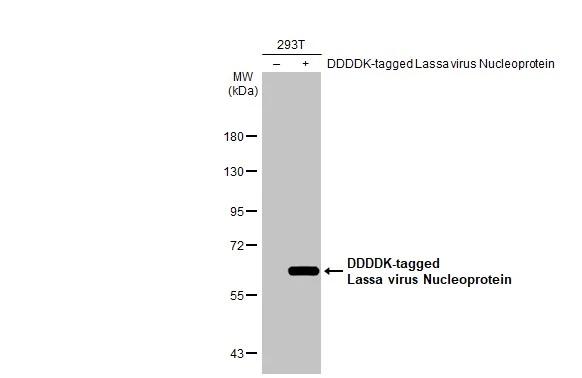Non-transfected (-) and transfected (+) 293T whole cell extracts (30 ug) were separated by 7.5% SDS-PAGE, and the membrane was blotted with Lassa virus Nucleoprotein antibody [HL1390] (NBP3-25547) diluted at 1:5000. The HRP-conjugated anti-rabbit IgG antibody was used to detect the primary antibody. 