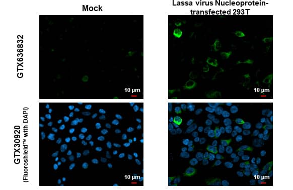 Immunocytochemistry/Immunofluorescence: Lassa virus Nucleoprotein Antibody (HL1392) - Azide and BSA Free [NBP3-25548] - Lassa virus Nucleoprotein antibody [HL1392] detects Lassa virus Nucleoprotein protein by immunofluorescent analysis. Sample: Mock and transfected 293T cells were fixed in 4% paraformaldehyde at RT for 15 min. Green: Lassa virus Nucleoprotein stained by Lassa virus Nucleoprotein antibody [HL1392] (NBP3-25548) diluted at 1:500. Blue: Fluoroshield with DAPI .