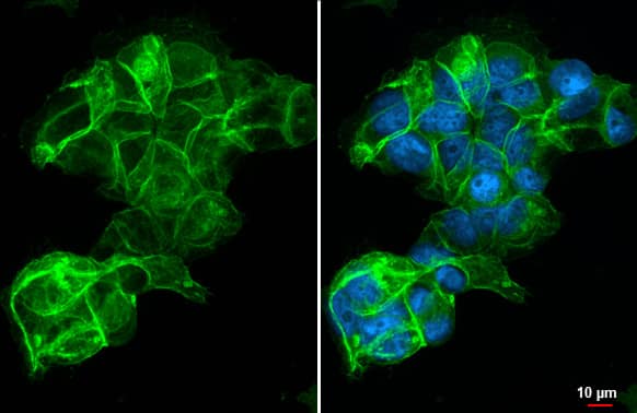 Immunocytochemistry/Immunofluorescence: SLC7A5/LAT1 Antibody (HL2353) - Azide and BSA Free [NBP3-25549] - LAT1 / SLC7A5 antibody [HL2353] detects LAT1 / SLC7A5 protein at cell membrane by immunofluorescent analysis. Sample: MCF-7 cells were fixed in ice-cold MeOH for 5 min. Green: LAT1 / SLC7A5 stained by LAT1 / SLC7A5 antibody [HL2353] (NBP3-25549) diluted at 1:500. Blue: Fluoroshield with DAPI .