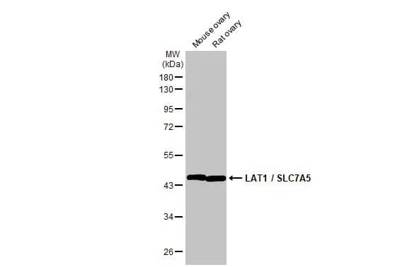 Western Blot: SLC7A5/LAT1 Antibody (HL2353) - Azide and BSA Free [NBP3-25549] - Various tissue extracts (50 ug) were separated by 10% SDS-PAGE, and the membrane was blotted with LAT1 / SLC7A5 antibody [HL2353] (NBP3-25549) diluted at 1:1000. The HRP-conjugated anti-rabbit IgG antibody was used to detect the primary antibody.