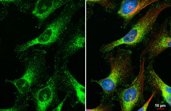 Immunocytochemistry/Immunofluorescence: Galectin-3BP/MAC-2BP/LGALS3BP Antibody (HL2168) - Azide and BSA Free [NBP3-25550] - LGALS3BP antibody [HL2168] detects LGALS3BP protein at endoplasmic reticulum and cell junction by immunofluorescent analysis. Sample: HeLa cells were fixed in 4% paraformaldehyde at RT for 15 min. Green: LGALS3BP stained by LGALS3BP antibody [HL2168] (NBP3-25550) diluted at 1:500. Red: alpha Tubulin, a cytoskeleton marker, stained by alpha Tubulin antibody [GT114] (NBP2-43837) diluted at 1:1000. Blue: Fluoroshield with DAPI .