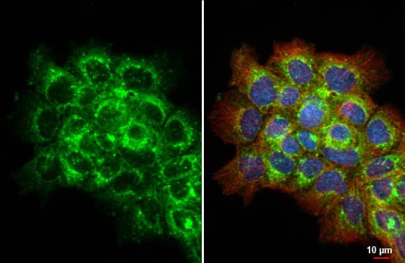 Immunocytochemistry/Immunofluorescence: Galectin-3BP/MAC-2BP/LGALS3BP Antibody (HL2168) - Azide and BSA Free [NBP3-25550] - LGALS3BP antibody [HL2168] detects LGALS3BP protein at cytoplasmic vesicle by immunofluorescent analysis. Sample: A431 cells were fixed in ice-cold MeOH for 5 min. Green: LGALS3BP stained by LGALS3BP antibody [HL2168] (NBP3-25550) diluted at 1:500. Red: alpha Tubulin, a cytoskeleton marker, stained by alpha Tubulin antibody [GT114] (NBP2-43837) diluted at 1:1000. Blue: Fluoroshield with DAPI .