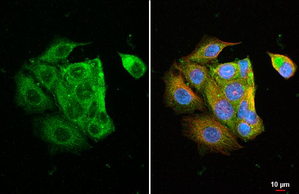 Immunocytochemistry/ Immunofluorescence Ly-6E Antibody (HL1933) - Azide and BSA Free