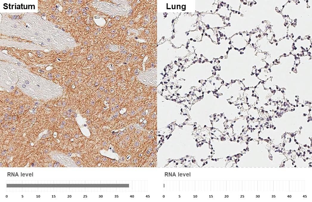 <b>Orthogonal Strategies Validation. </b>MAP2 antibody [HL1655] detects MAP2 protein by immunohistochemical analysis.Sample: Paraffin-embedded mouse tissues.MAP2 stained by MAP2 antibody [HL1655] (NBP3-25554) diluted at 1:100.Antigen Retrieval: Citrate buffer, pH 6.0, 15 min 