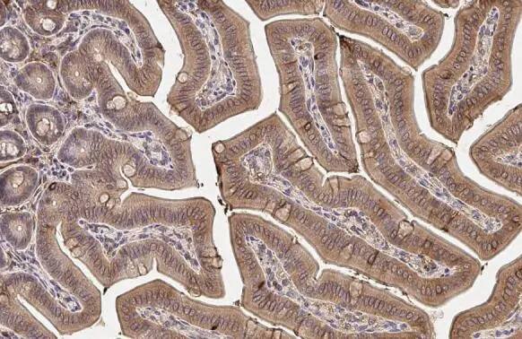 Immunohistochemistry-Paraffin: MAP3K8/Tpl2/COT Antibody (HL2118) - Azide and BSA Free [NBP3-25556] - MAP3K8 antibody [HL2118] detects MAP3K8 protein at cell membrane by immunohistochemical analysis. Sample: Paraffin-embedded mouse intestine. MAP3K8 stained by MAP3K8 antibody [HL2118] (NBP3-25556) diluted at 1:100. Antigen Retrieval: Citrate buffer, pH 6.0, 15 min