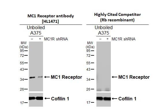 Non-transfected (-) and transfected (+) unboiled A375 whole cell extracts (30 ug) were separated by 12% SDS-PAGE, and the membranes were blotted with Melanocortin-1 R/MC1R antibody [HL1471] (NBP3-25558) diluted at 1:5000 and competitor's antibody (Highly Cited Competitor) diluted at 1:5000. The HRP-conjugated anti-rabbit IgG antibody was used to detect the primary antibody.*The competitor is not affiliated withand does not endorse this product. 