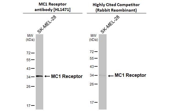 Whole cell extract (30 ug) was separated by 12% SDS-PAGE, and the membranes were blotted with Melanocortin-1 R/MC1R antibody [HL1471] (NBP3-25558) diluted at 1:50000 and competitor's antibody diluted at 1:1000. The HRP-conjugated anti-rabbit IgG antibody was used to detect the primary antibody.*The competitor is not affiliated withand does not endorse this product. 