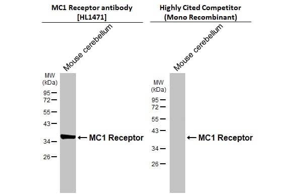 Various tissue extracts (50 ug) was separated by 12% SDS-PAGE, and the membranes were blotted with Melanocortin-1 R/MC1R antibody [HL1471] (NBP3-25558) diluted at 1:1000 and competitor's antibody (Competitor) diluted at 1:1000. The HRP-conjugated anti-rabbit IgG antibody was used to detect the primary antibody.*The competitor is not affiliated withand does not endorse this product. 