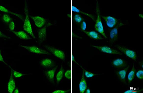 Immunocytochemistry/Immunofluorescence: METTL1 Antibody (HL2041) - Azide and BSA Free [NBP3-25561] - METTL1 antibody [HL2041] detects METTL1 protein at cytoplasm and nucleus by immunofluorescent analysis. Sample: RMS-13 cells were fixed in ice-cold MeOH for 5 min. Green: METTL1 stained by METTL1 antibody [HL2041] (NBP3-25561) diluted at 1:500. Blue: Fluoroshield with DAPI .