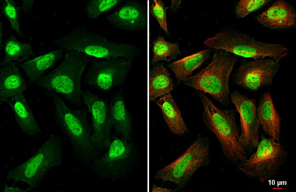 Immunocytochemistry/Immunofluorescence: METTL14 Antibody (HL1816) - Azide and BSA Free [NBP3-25562] - METTL14 antibody [HL1816] detects METTL14 protein by immunofluorescent analysis. Sample: U2OS cells were fixed in 4% paraformaldehyde at RT for 15 min. Green: METTL14 stained by METTL14 antibody [HL1816] (NBP3-25562) diluted at 1:500. Red: alpha Tubulin, a cytoskeleton marker, stained by alpha Tubulin antibody [GT114] diluted at 1:1000.