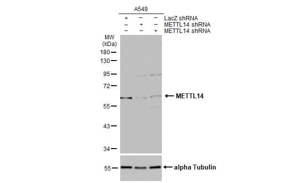 <b>Genetic Strategies Validation. </b>Western Blot: METTL14 Antibody (HL1816) - Azide and BSA Free [NBP3-25562] - Untransfected (-) and transfected (+) A549 whole cell extract (30 ug) were separated by 10% SDS-PAGE, and the membrane was blotted with METTL14 antibody [HL1816] (NBP3-25562) diluted at 1:2000. The HRP-conjugated anti-rabbit IgG antibody was used to detect the primary antibody.