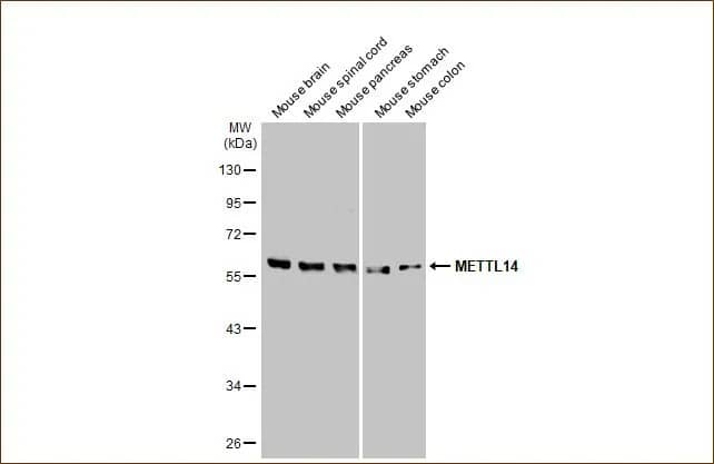 Western Blot: METTL14 Antibody (HL1816) - Azide and BSA Free [NBP3-25562] - Various whole cell extracts (50 ug) were separated by 10% SDS-PAGE, and the membrane was blotted with METTL14 antibody [HL1816] (NBP3-25562) diluted at 1:1000. The HRP-conjugated anti-rabbit IgG antibody was used to detect the primary antibody.