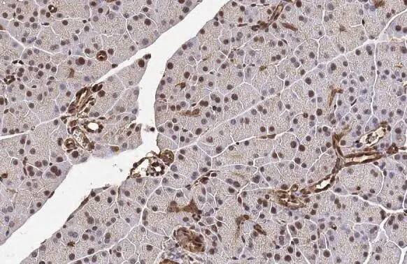 Immunohistochemistry-Paraffin: METTL14 Antibody (HL1816) - Azide and BSA Free [NBP3-25562] - METTL14 antibody [HL1816] detects METTL14 protein at nucleus by immunohistochemical analysis. Sample: Paraffin-embedded mouse pancreas. METTL14 stained by METTL14 antibody [HL1816] (NBP3-25562) diluted at 1:100. Antigen Retrieval: Citrate buffer, pH 6.0, 15 min