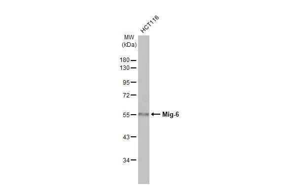 Western Blot: ERRFI1 Antibody (HL1785) - Azide and BSA Free [NBP3-25564] - Whole cell extract (30 ug) was separated by 10% SDS-PAGE, and the membrane was blotted with Mig-6 antibody [HL1785] (NBP3-25564) diluted at 1:500. The HRP-conjugated anti-rabbit IgG antibody was used to detect the primary antibody.