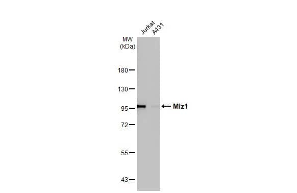 Western Blot: Miz-1/ZBTB17 Antibody (HL1548) - Azide and BSA Free [NBP3-25565] - Various whole cell extracts (30 ug) were separated by 7.5% SDS-PAGE, and the membrane was blotted with Miz1 antibody [HL1548] (NBP3-25565) diluted at 1:1000. The HRP-conjugated anti-rabbit IgG antibody was used to detect the primary antibody, and the signal was developed with Trident ECL plus-Enhanced.