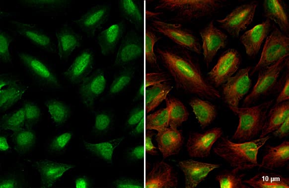 Immunocytochemistry/Immunofluorescence: Miz-1/ZBTB17 Antibody (HL1548) - Azide and BSA Free [NBP3-25565] - Miz1 antibody [HL1548] detects Miz1 protein by immunofluorescent analysis. Sample: U2OS cells were fixed in 4% paraformaldehyde at RT for 15 min. Green: Miz1 stained by Miz1 antibody [HL1548] (NBP3-25565) diluted at 1:500. Red: alpha Tubulin, a cytoskeleton marker, stained by alpha Tubulin antibody [GT114] diluted at 1:1000.