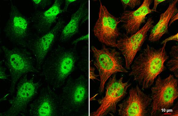 Immunocytochemistry/Immunofluorescence: MAX binding protein Antibody (HL2309) - Azide and BSA Free [NBP3-25567] - MNT antibody [HL2309] detects MNT protein at cytoplasm and nucleus by immunofluorescent analysis. Sample: HeLa cells were fixed in 4% paraformaldehyde at RT for 15 min. Green: MNT stained by MNT antibody [HL2309] (NBP3-25567) diluted at 1:500. Red: alpha Tubulin, a cytoskeleton marker, stained by alpha Tubulin antibody [GT114] diluted at 1:1000.