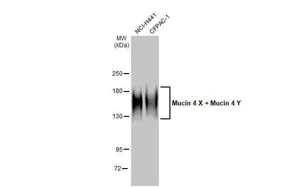 Western Blot: MUC4 Antibody (HL2026) - Azide and BSA Free [NBP3-25569] - Various whole cell extracts (30 ug) were separated by 5% SDS-PAGE, and the membrane was blotted with Mucin 4 X + Mucin 4 Y antibody [HL2026] (NBP3-25569) diluted at 1:1000. The HRP-conjugated anti-rabbit IgG antibody was used to detect the primary antibody.