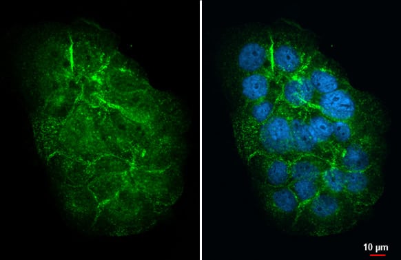 Immunocytochemistry/Immunofluorescence: MUC4 Antibody (HL2026) - Azide and BSA Free [NBP3-25569] - Mucin 4 X + Mucin 4 Y antibody [HL2026] detects Mucin 4 X + Mucin 4 Y protein at cell membrane by immunofluorescent analysis. Sample: NCI-H441 cells were fixed in ice-cold MeOH for 5 min. Green: Mucin 4 X + Mucin 4 Y stained by Mucin 4 X + Mucin 4 Y antibody [HL2026] (NBP3-25569) diluted at 1:500. Blue: Fluoroshield with DAPI .