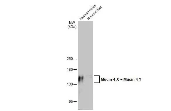 Western Blot: MUC4 Antibody (HL2026) - Azide and BSA Free [NBP3-25569] - Various tissue extracts (30 ug) were separated by 5% SDS-PAGE, and the membrane was blotted with Mucin 4 X + Mucin 4 Y antibody [HL2026] (NBP3-25569) diluted at 1:1000. The HRP-conjugated anti-rabbit IgG antibody was used to detect the primary antibody.